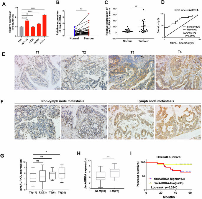 CircAURKA Drives Colorectal Cancer Growth by Stabilizing CTNNB1